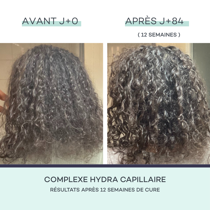 Complesso Idra-Capillare