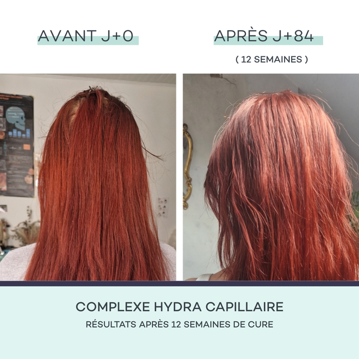 Complesso Idra-Capillare