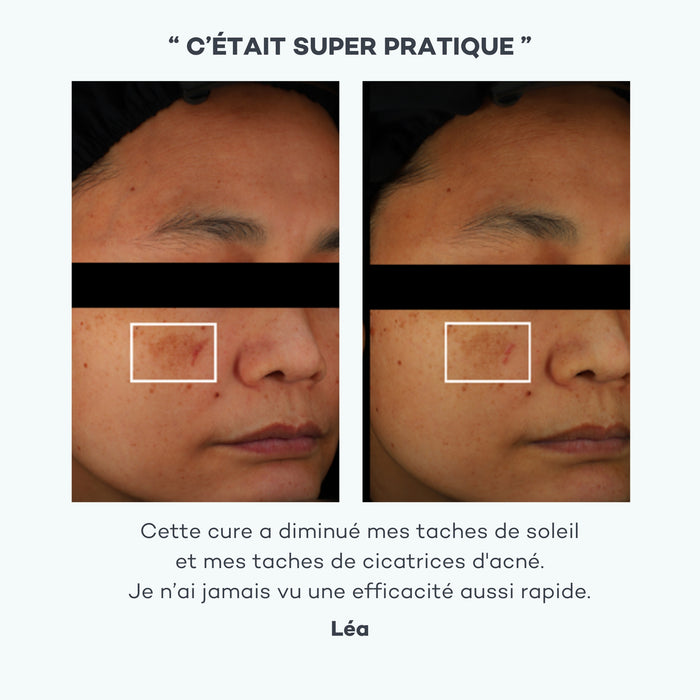 avant après solution anti-tache