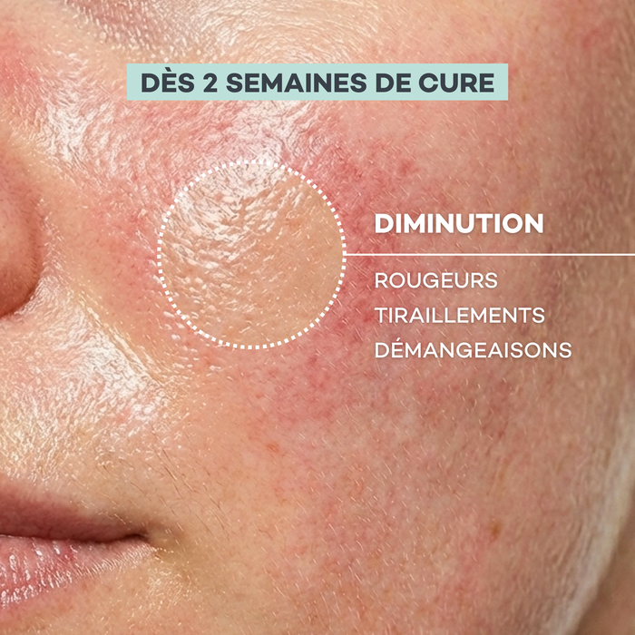 Routine Pelle Sensibile