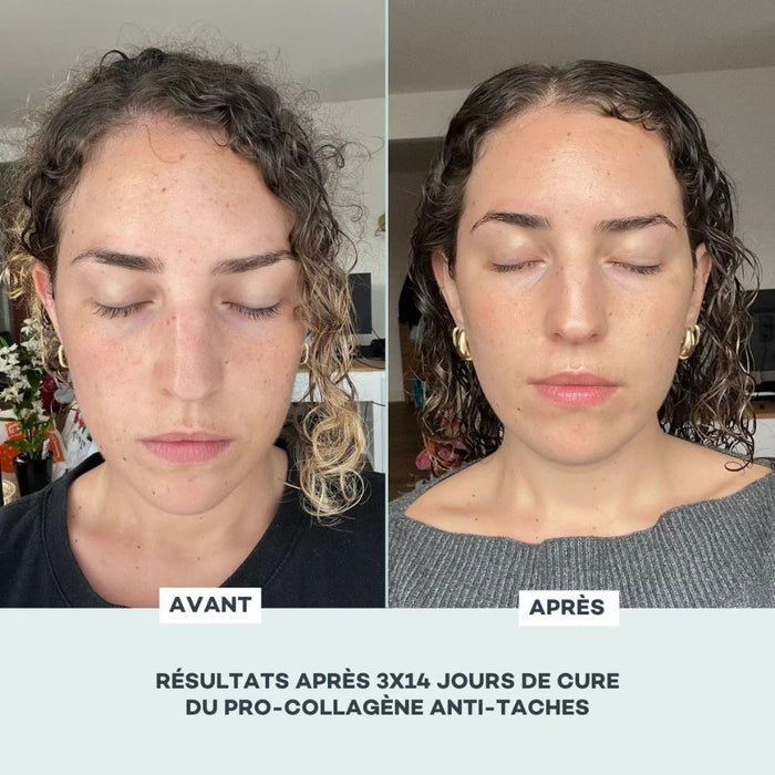 Soluzione Anti-Macchie