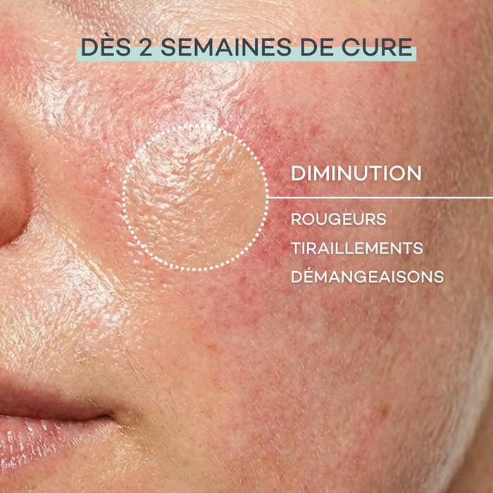 Routine Pelle Sensibile