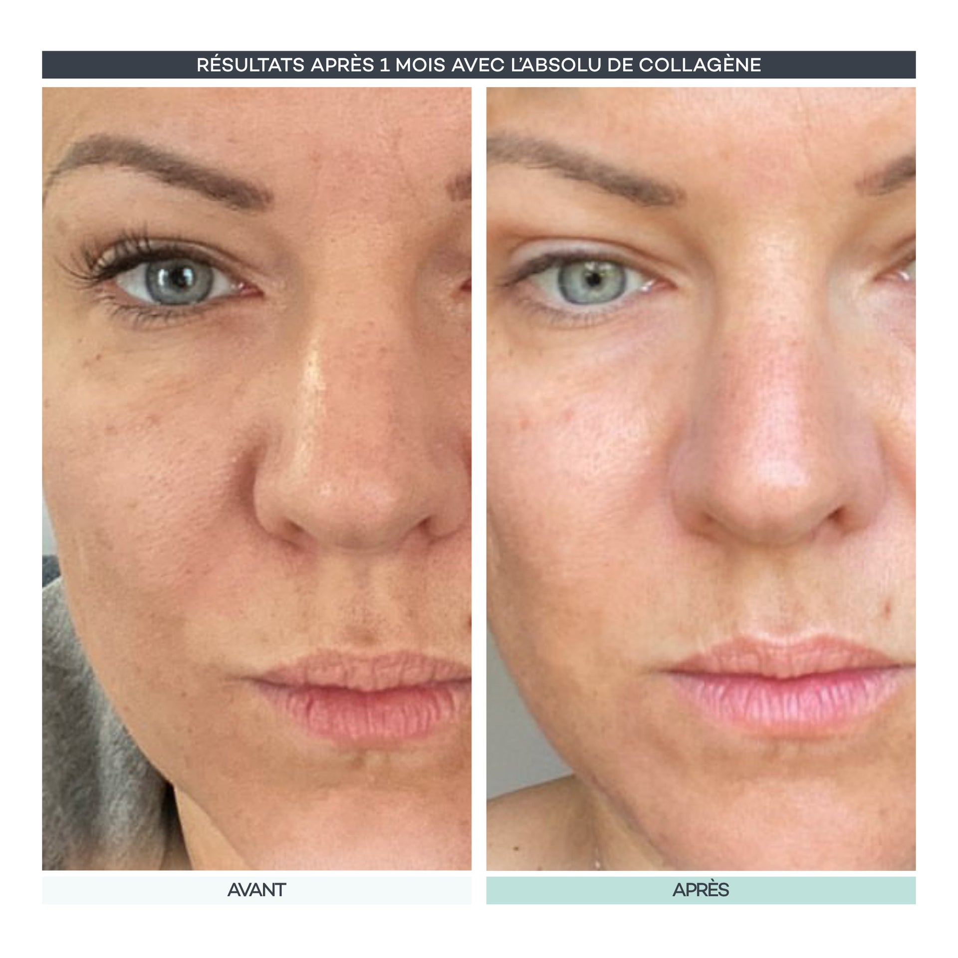 Assoluto di collagene