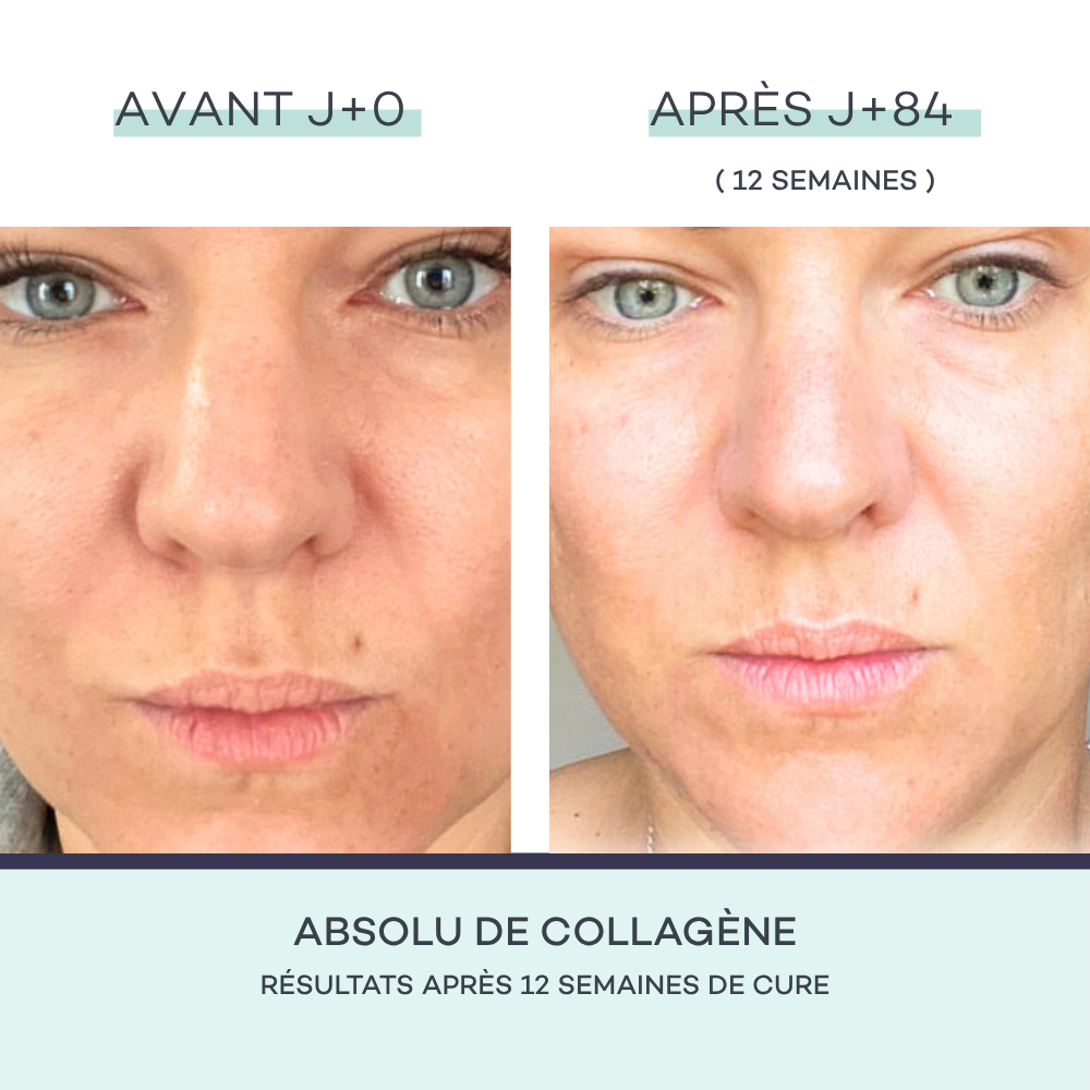 Assoluto di collagene