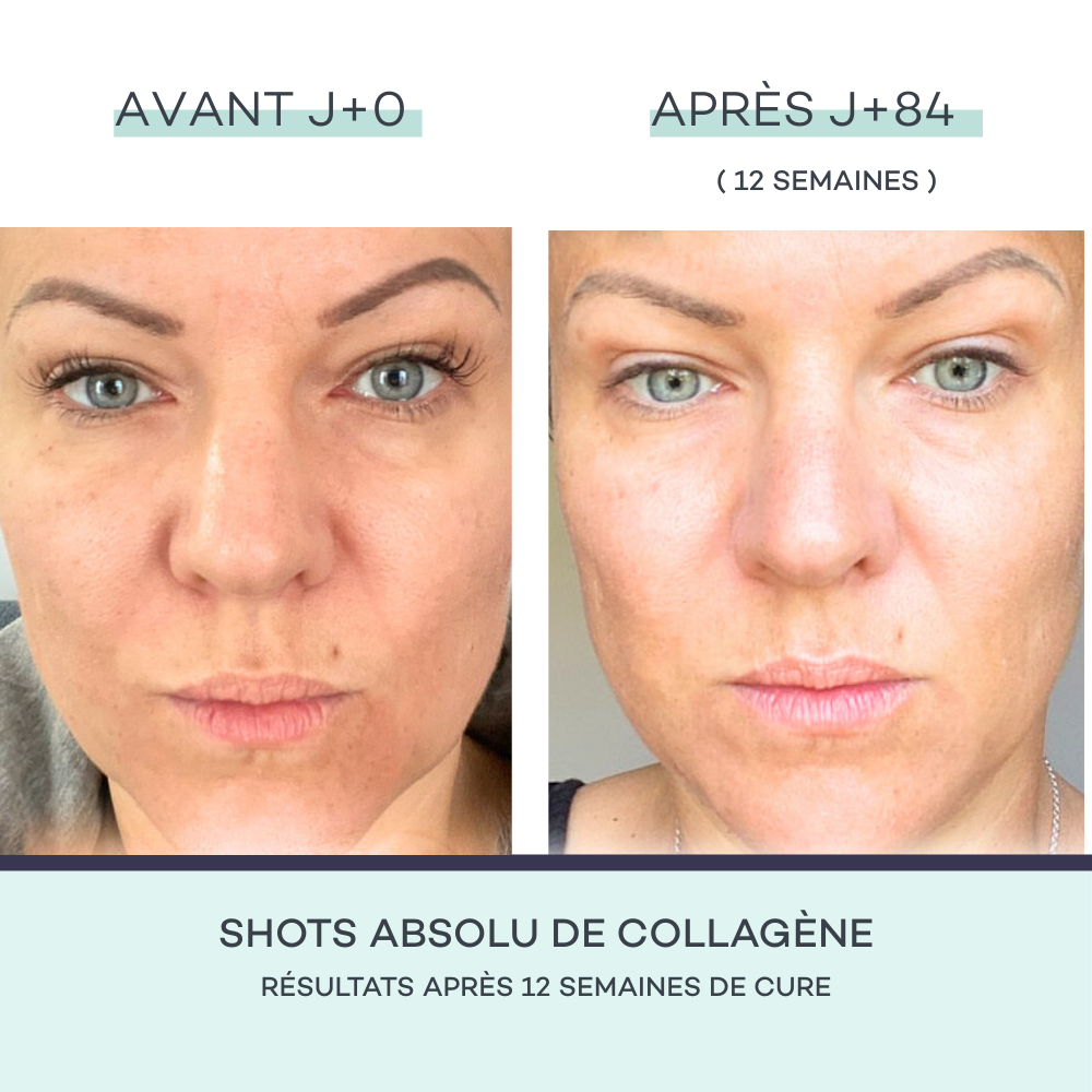 Shot di Collagene