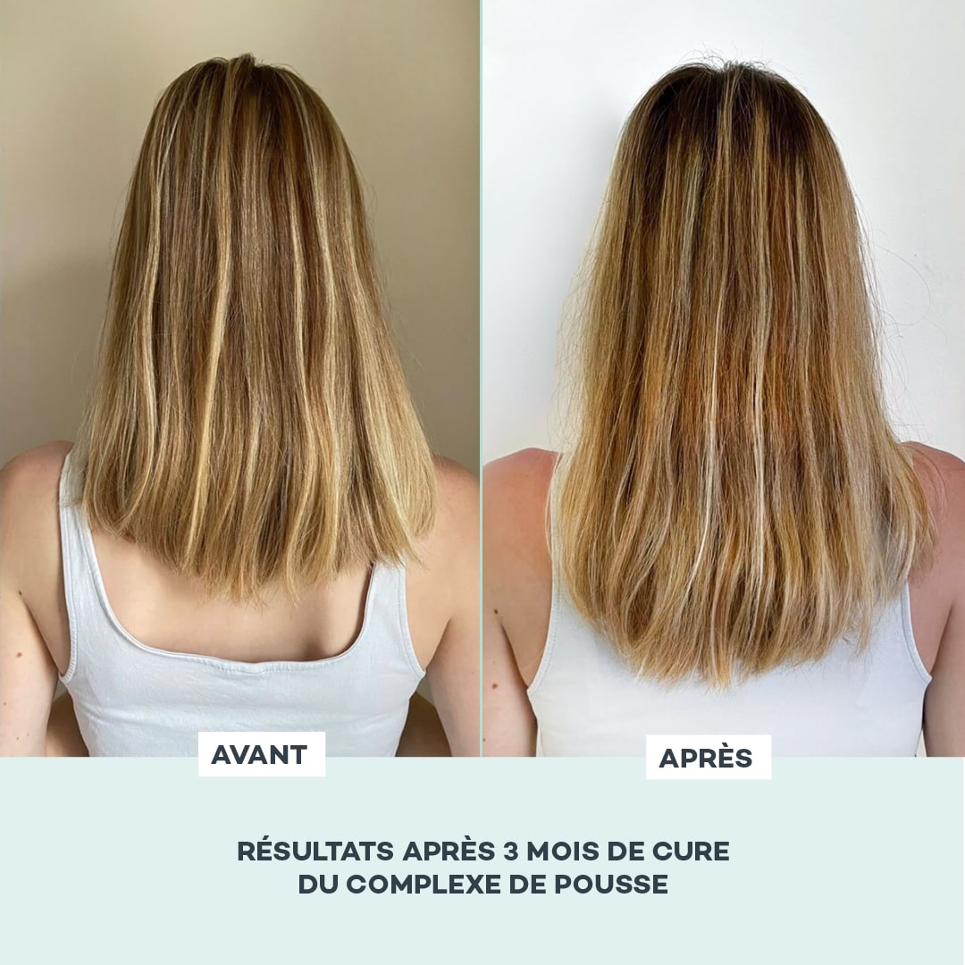 cure cheveux pousse