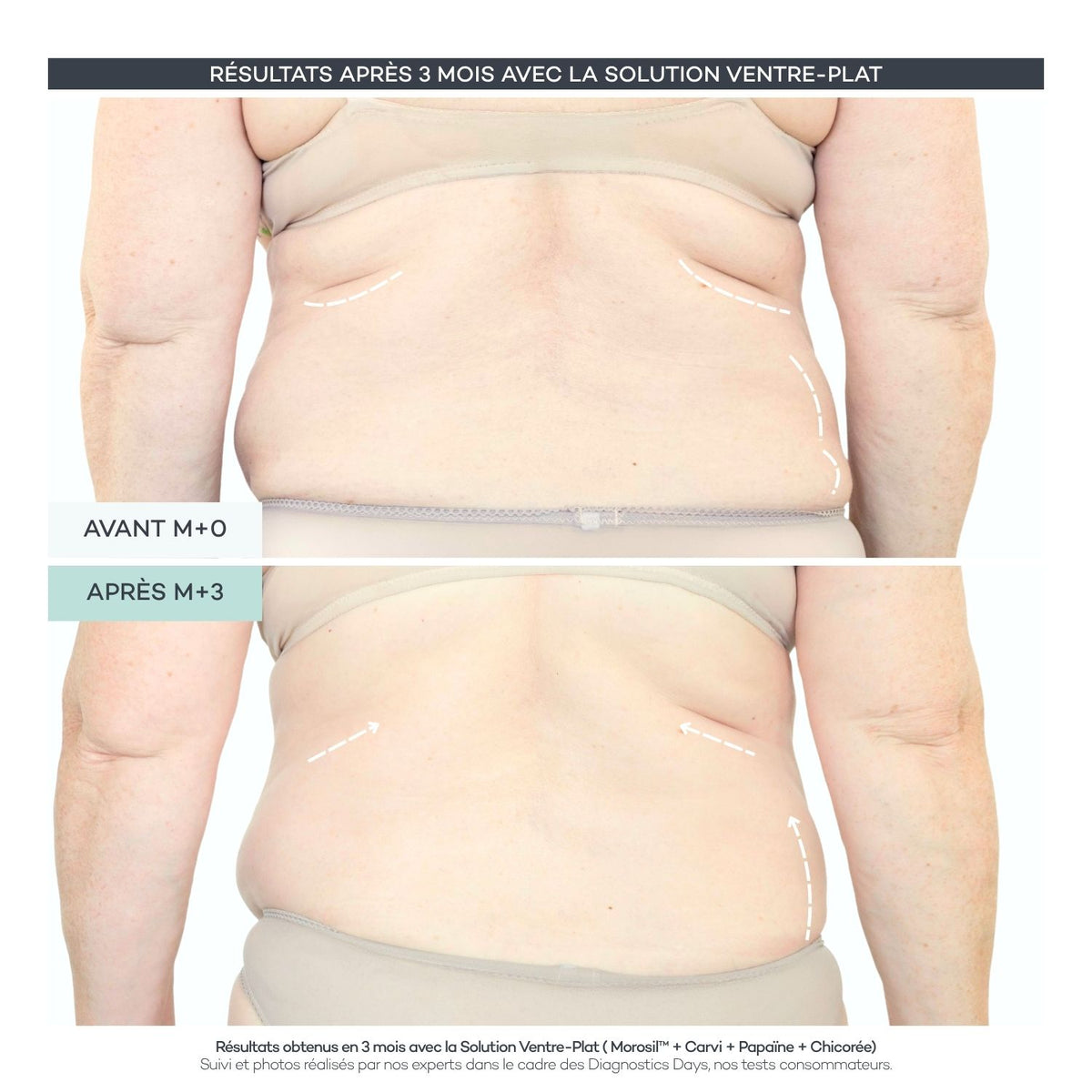 Soluzione Pancia Piatta - Body Reset