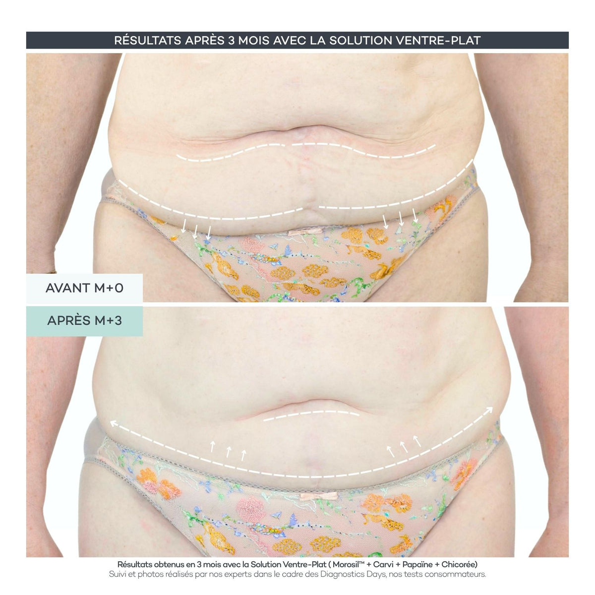 Soluzione Pancia Piatta - Body Reset