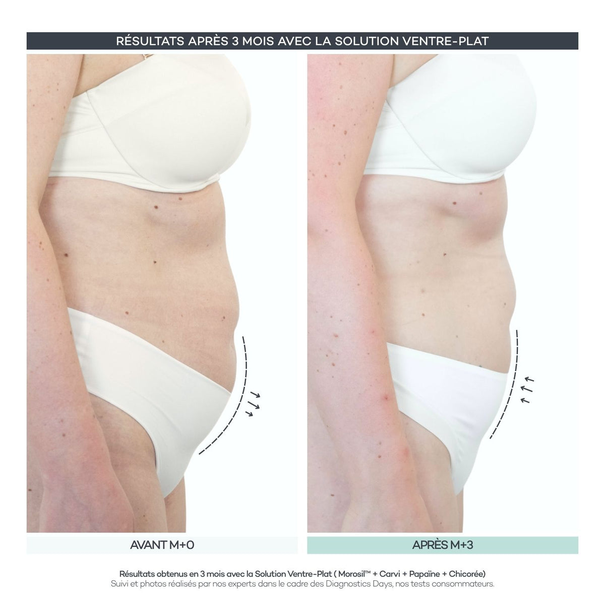 Soluzione Pancia Piatta - Body Reset