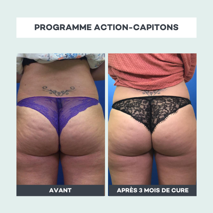 Routine Azione-Capitoni