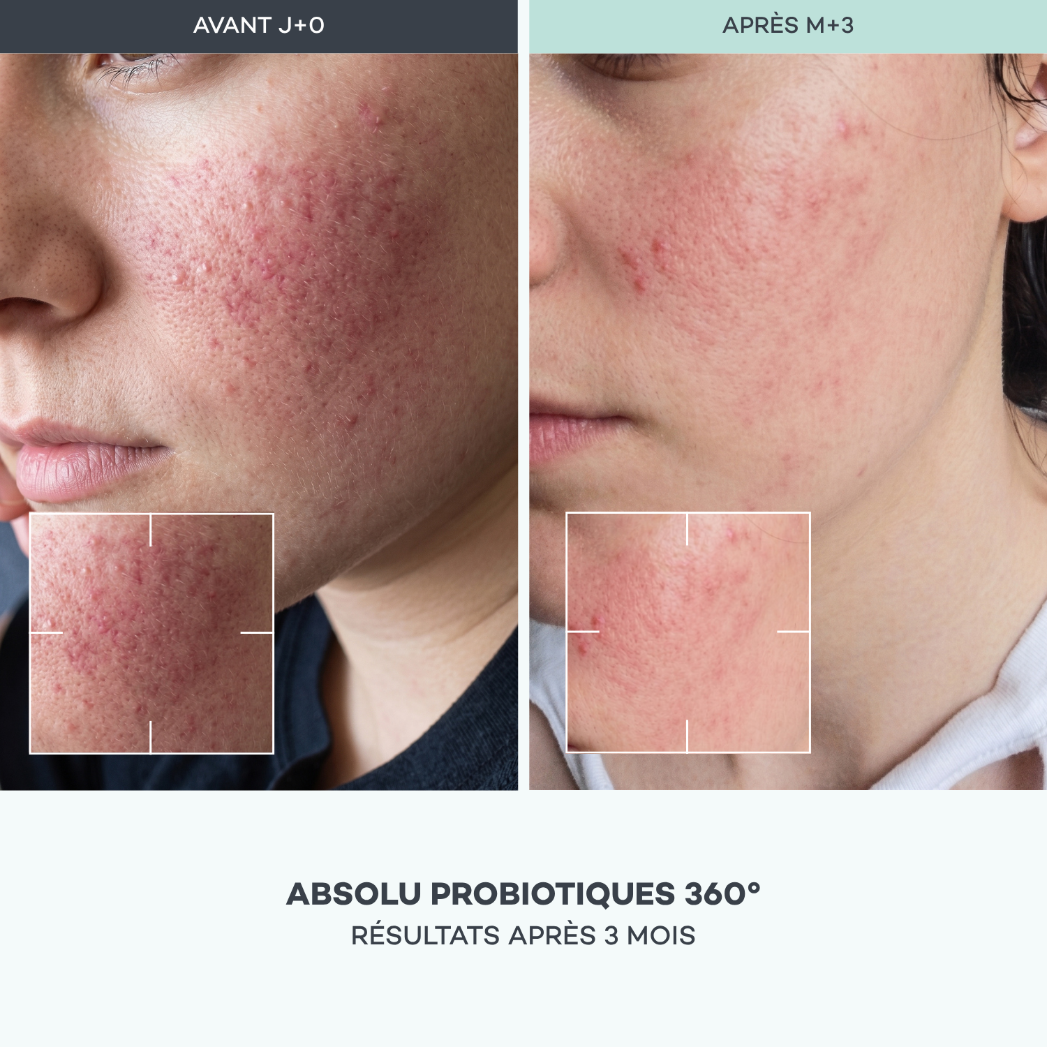 Absolu Probiotici 360°