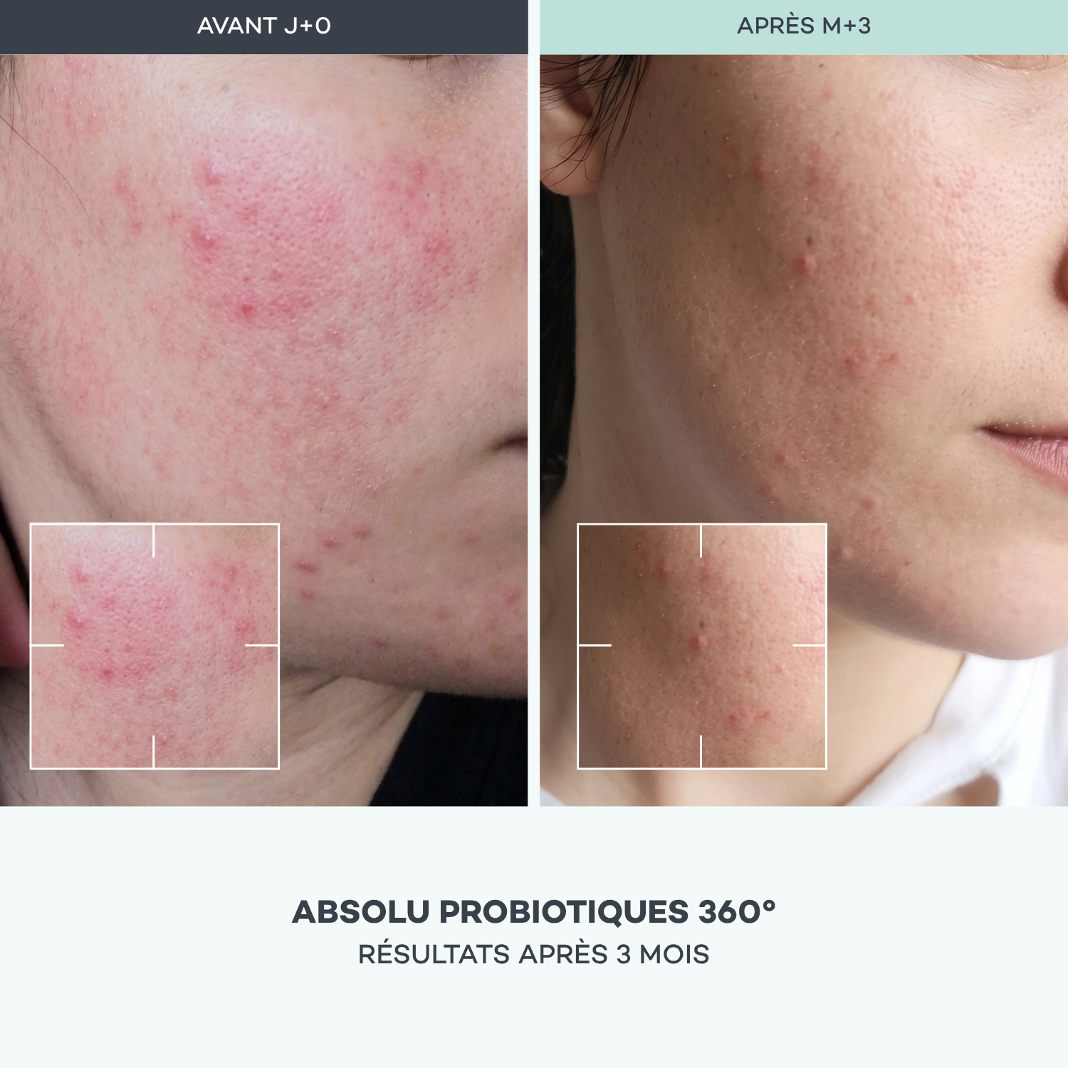Absolu Probiotici 360°