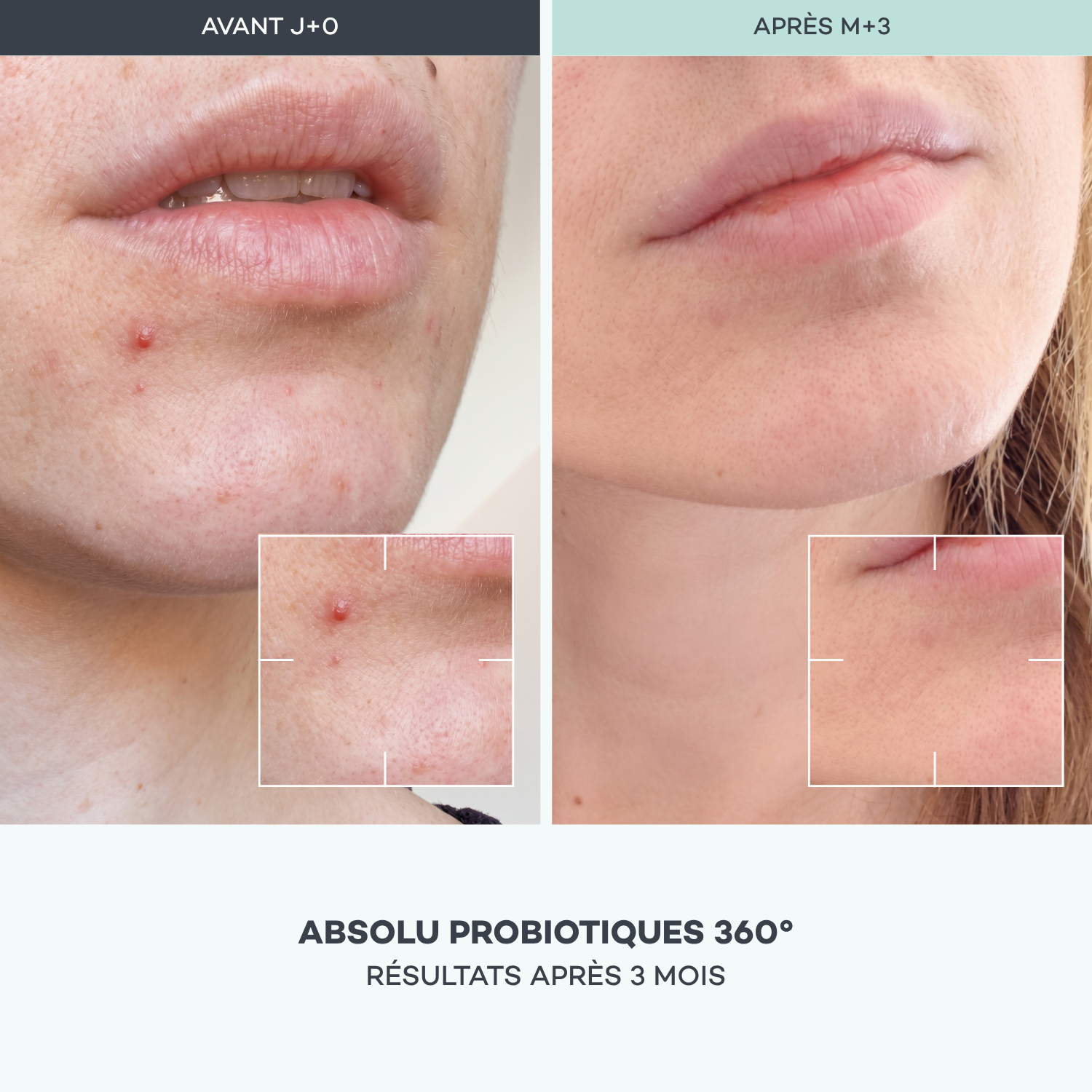 Absolu Probiotici 360°