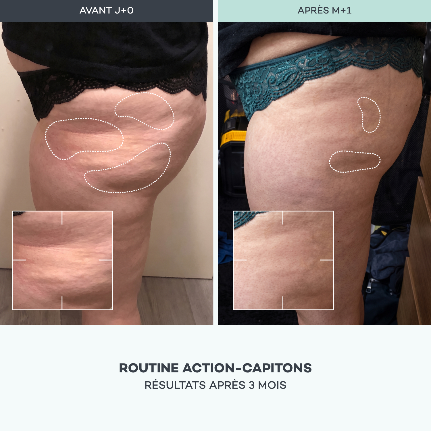 Routine Azione-Capitoni