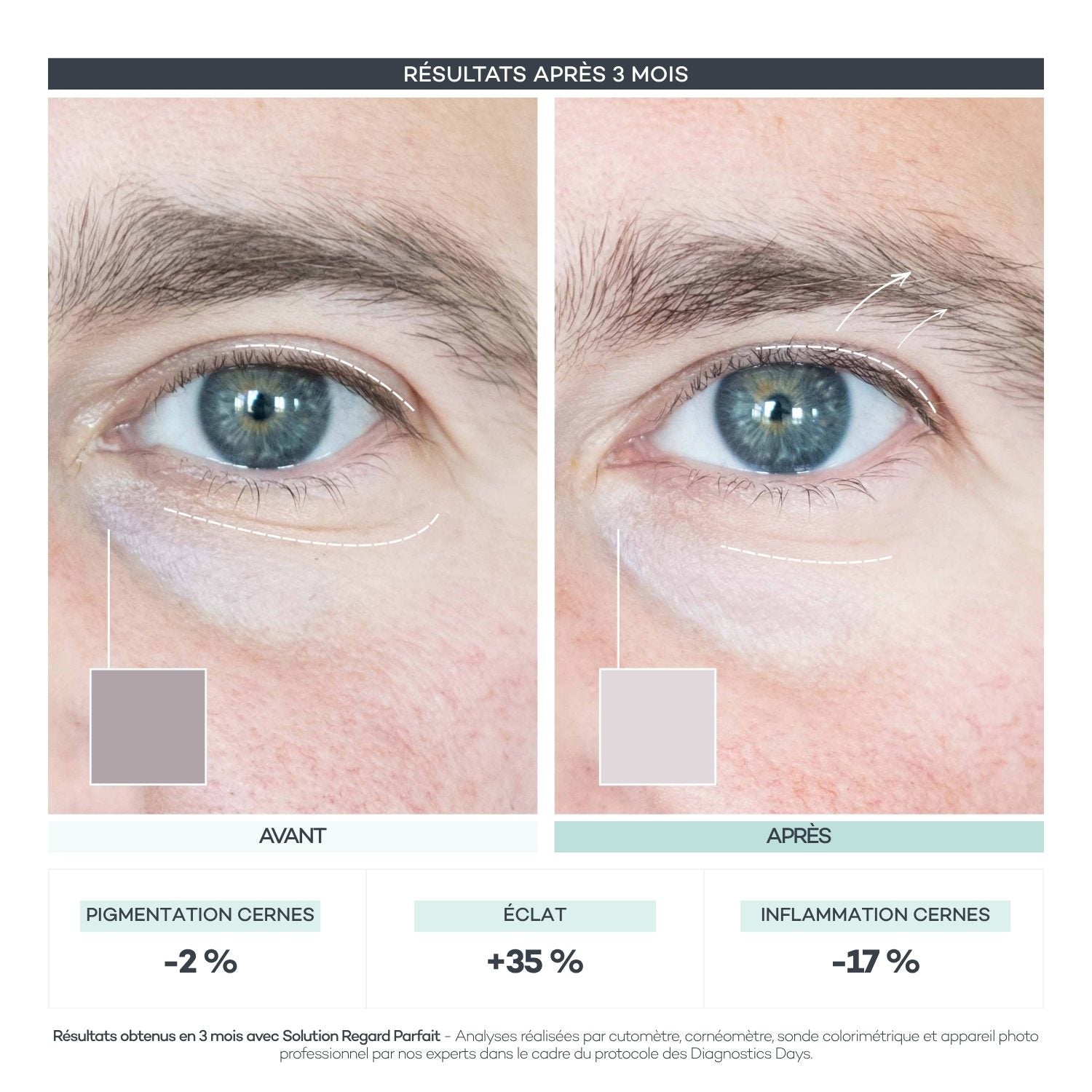 Avant/après Diagnostics Days — Regard Parfait